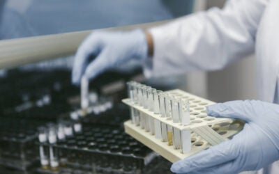 How Public Water Systems Test for Bacteria in Water